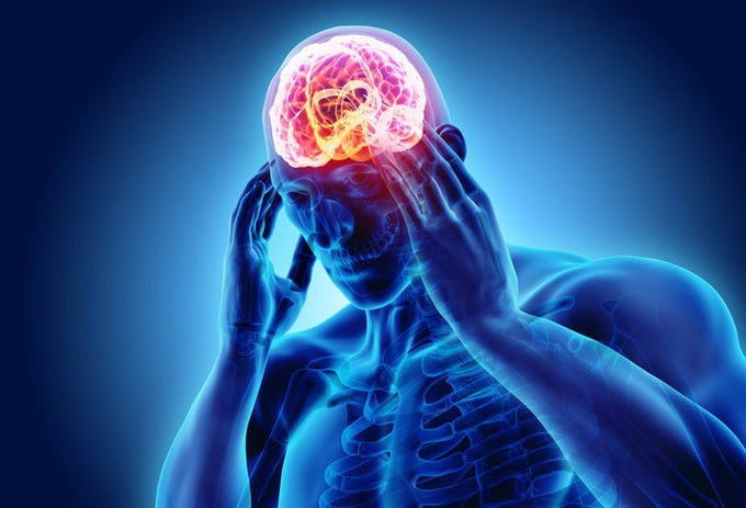 Giảm muối giúp ngăn chứng đau đầu hiệu quả