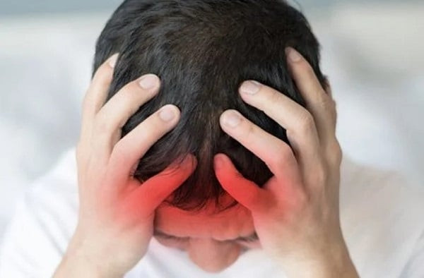 Người mắc cơn thiếu máu não thoáng qua thường bị đau đầu dữ dội. Ảnh minh họa: Internet