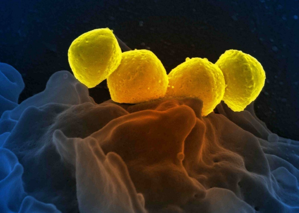 Vi khuẩn 'ăn thịt người' gây tử vong trong 48 giờ lây lan tại Nhật Bản