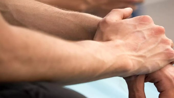 Gân xanh tập trung nhiều dưới da tay, nhất là ở mu bàn tay, là biểu hiện của bệnh giãn tĩnh mạch tay, thường gặp ở người lớn tuổi