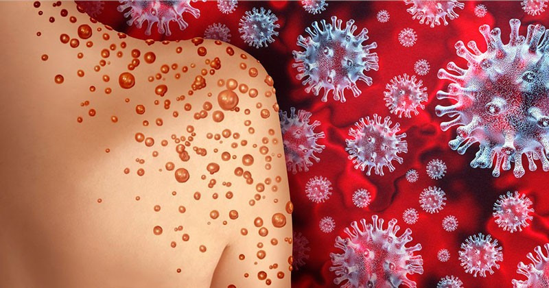 Nóng: WHO phát động chiến dịch toàn cầu khống chế virus mới, dự kiến bắt đầu từ tháng sau - ảnh 1