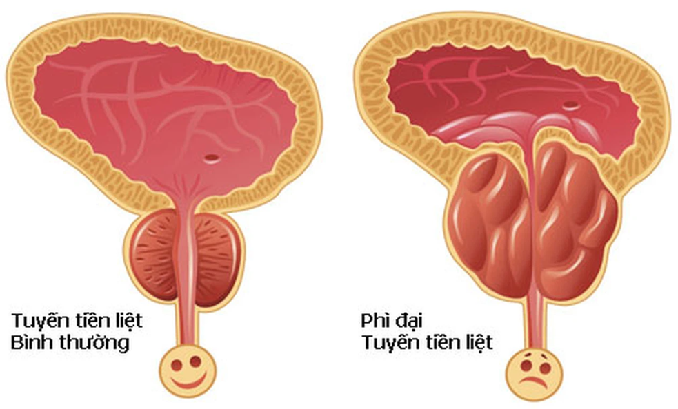 Phát hiện loại vitamin có thể ức chế sự phát triển của ung thư - ảnh 2