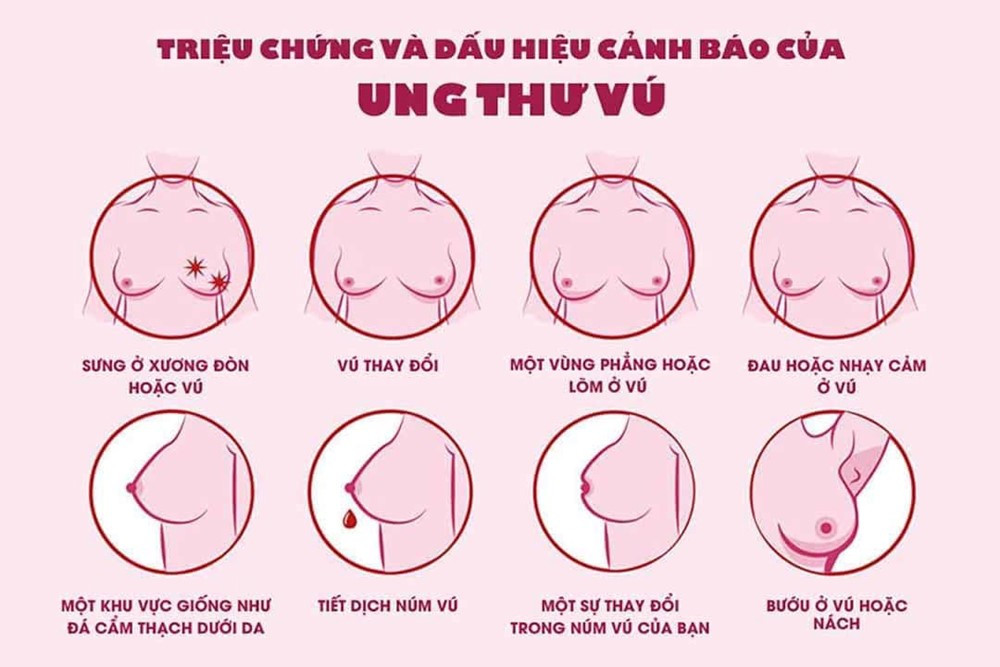 Bệnh viện K chỉ ra dấu hiệu cảnh báo loại ung thư mà Diva Hồng Nhung mắc, nữ giới cần đặc biệt lưu ý - ảnh 2