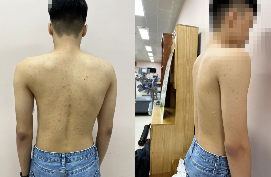 Từ ngày 12/5, Bệnh viện Trung ương Quân đội 108 tổ chức khám sàng lọc, chẩn đoán hình ảnh miễn phí cho trẻ dưới 18 tuổi đối với loại bệnh lý này - ảnh 1