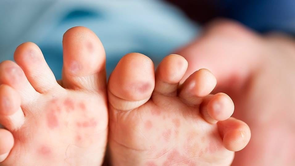 Bộ Y tế đưa khuyến cáo quan trọng tới người dân cả nước - ảnh 2