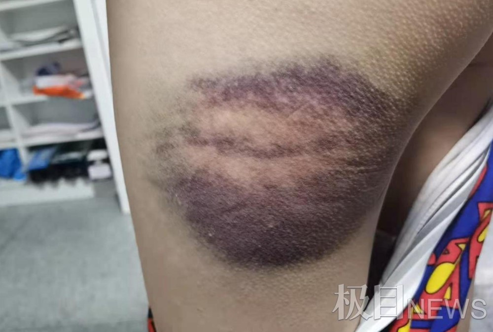 Bắt hiệu trưởng một trại hè dành cho trẻ nhỏ - ảnh 3