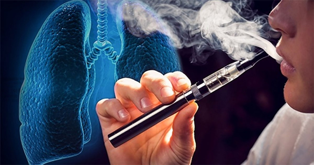 Số trẻ từ 13-15 tuổi sử dụng thuốc lá điện tử đang nhiều hơn so với số người trưởng thành. 58tla.jpg