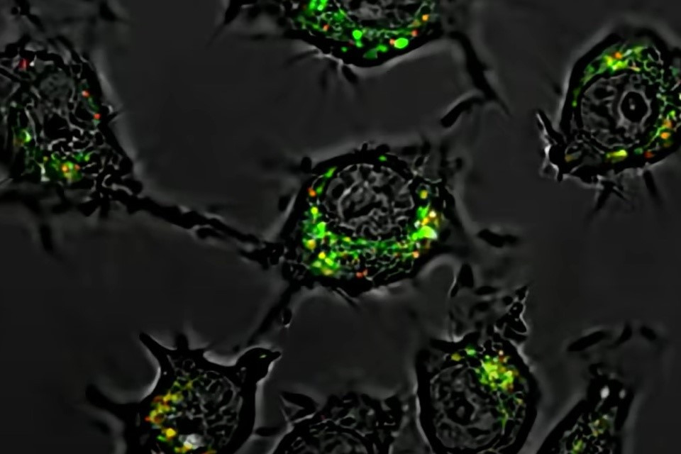 Phát hiện thuốc mới tiêu diệt tế bào ung thư mạnh gấp 20.000 lần, không gây tác dụng phụ - ảnh 1