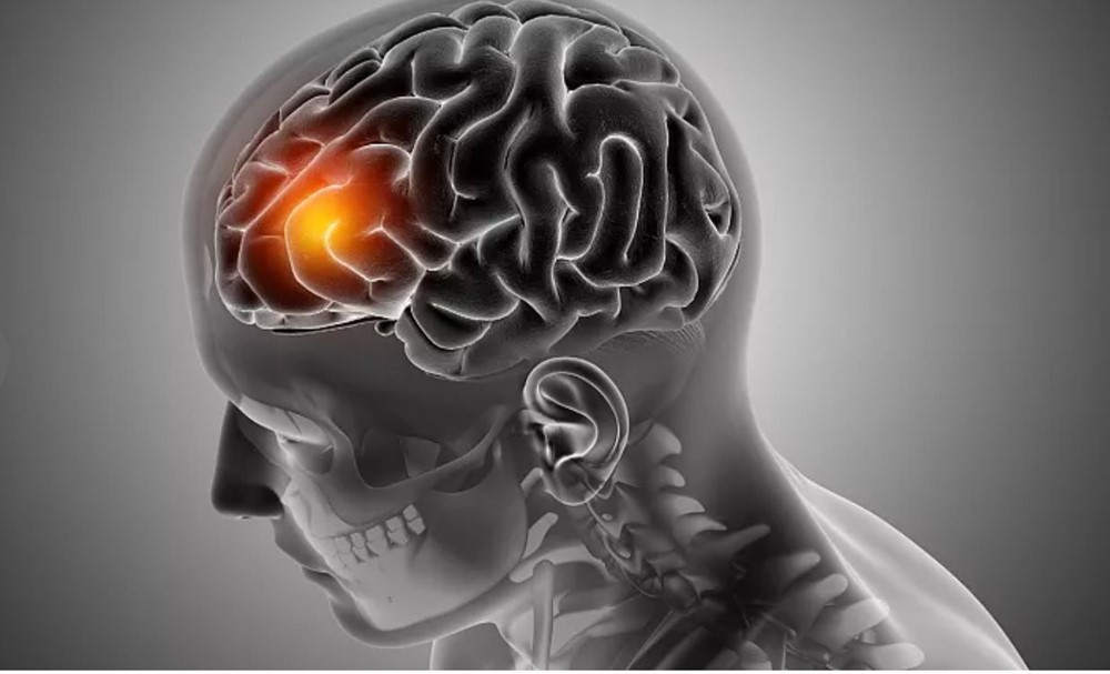 Phát triển thuốc điều trị ung thư dạng nhỏ mũi - ảnh 1