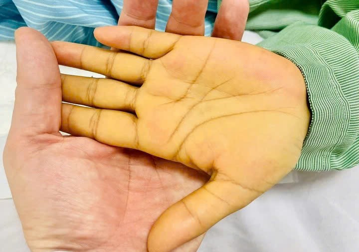 6 nhóm người cần đi khám gan định kỳ để phòng ngừa ung thư và biến chứng nguy hiểm - ảnh 2