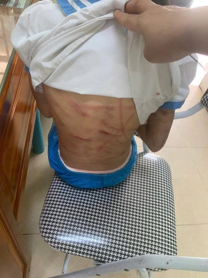 Khám xét khẩn cấp, khởi tố thêm tội danh với 'cha dượng' Nguyễn Văn Nam - ảnh 1