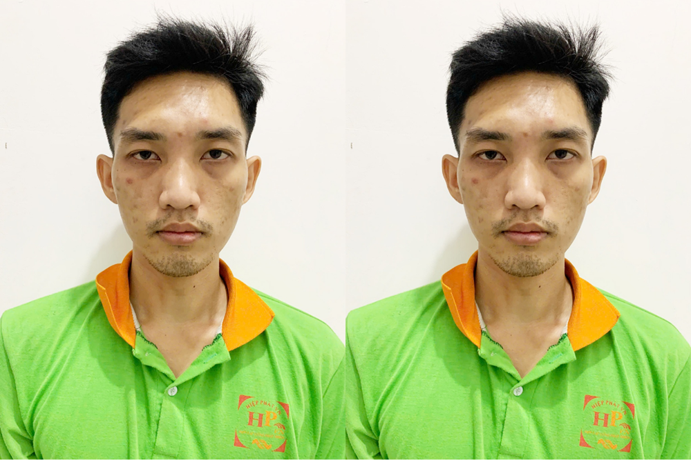 Nguyễn Quốc Thịnh, 30 tuổi bị truy nã vì trộm 17kg khô mực ra đầu thú