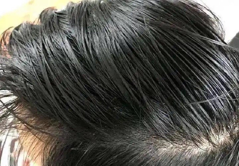 Đàn ông có thể sống thọ bao lâu chỉ cần nhìn mái tóc là biết? Cảnh báo nếu xuất hiện 3 dấu hiệu này, cần đặc biệt chú ý! - ảnh 4