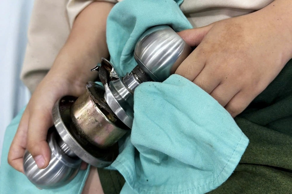 Bé trai 5 tuổi nhập viện cấp cứu vì kẹt ngón tay vào ổ khóa cửa - ảnh 1