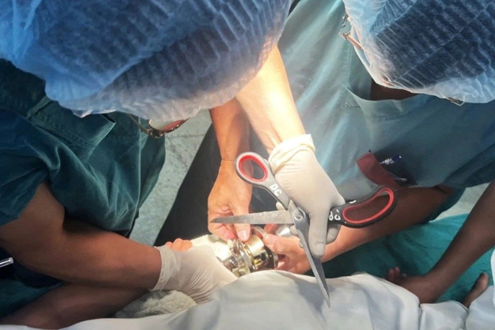 Bé trai 5 tuổi nhập viện cấp cứu vì kẹt ngón tay vào ổ khóa cửa - ảnh 2