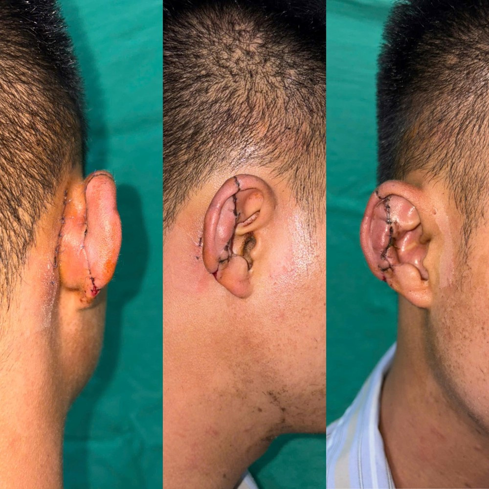 Một bệnh viện Trung ương thông báo tin vui, xử trí thành công ca bệnh hy hữu - ảnh 2