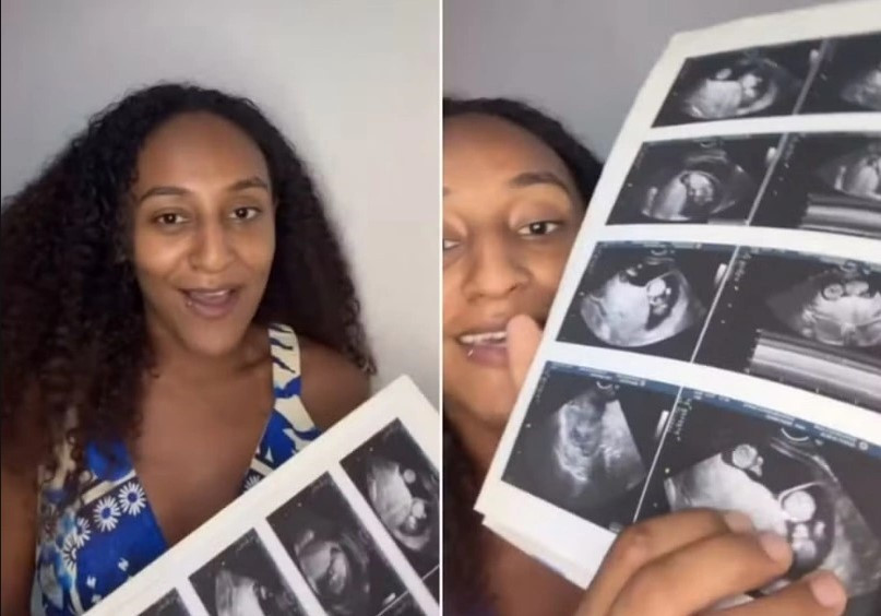 Cô gái 24 tuổi mang thai khi đang có bầu, phải sinh thường lẫn sinh mổ chỉ trong một đêm - ảnh 1