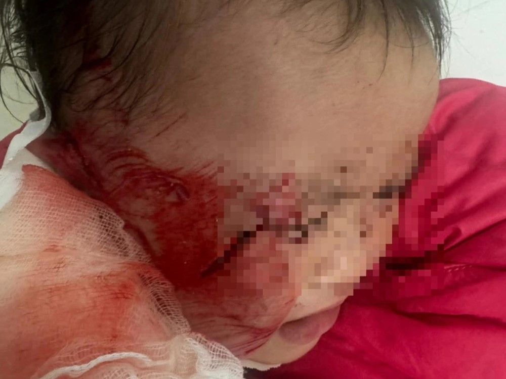 Trần thạch cao đổ sập đè trúng nhiều trẻ mầm non đang ngủ trưa - ảnh 2