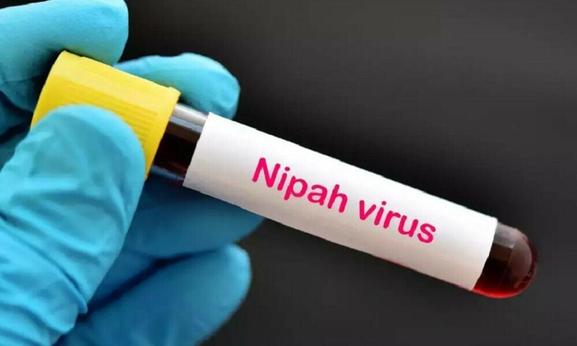 Nguy cơ bùng phát loại virus tỷ lệ tử vong tới 75%, không có vắc-xin, chuyên gia cảnh báo phải phòng tránh ngay từ đầu - ảnh 3