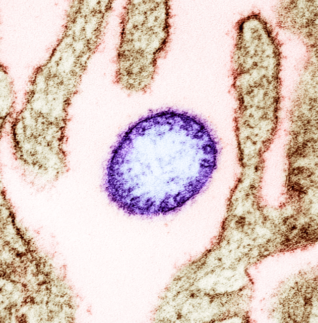 Thức uống xuất hiện trong đám cưới bị nghi là nguồn lây virus Nipah - ảnh 1
