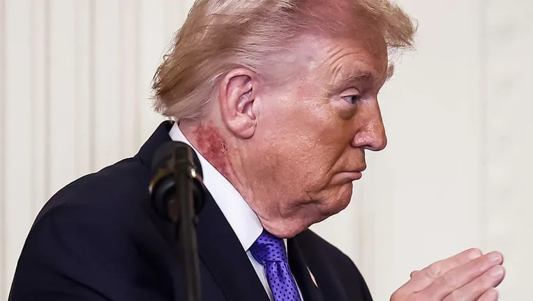 trump-rash.jpg