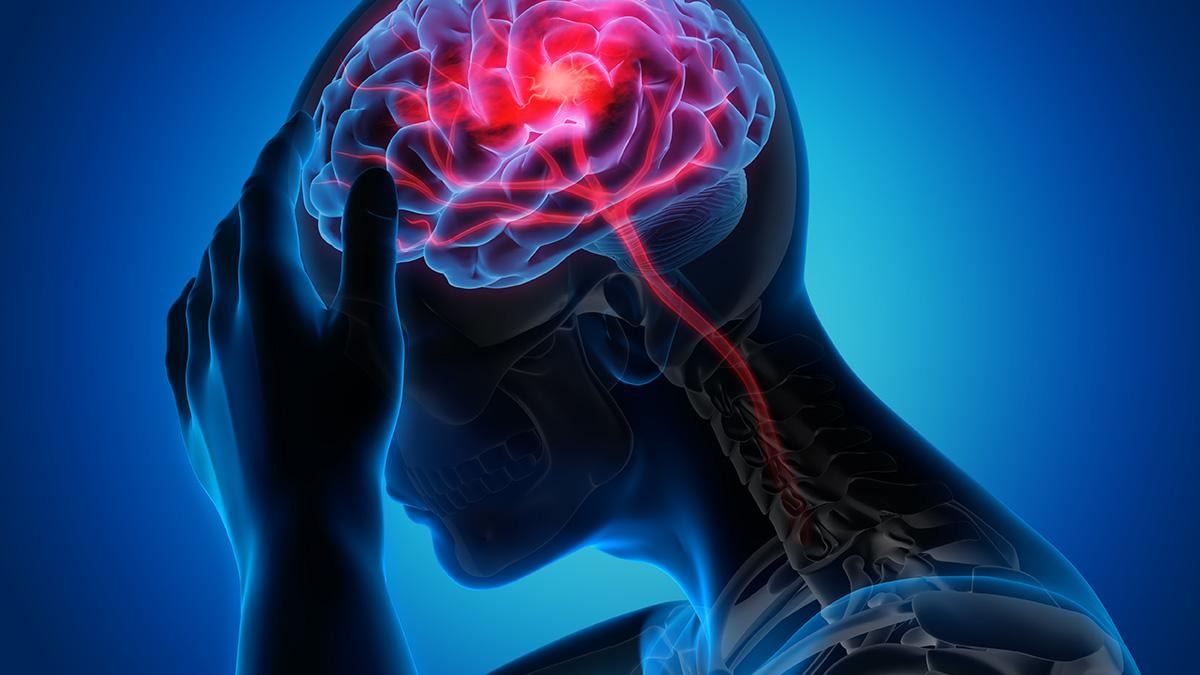 signs-symptoms-stroke-17749304100601597255103-1774932419930-1774932420139443530998_1775013044.jpg