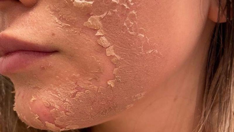 peel-da-co-tot-khong-11-tac-dung-luu-y--15--800x450_1776503288.jpg
