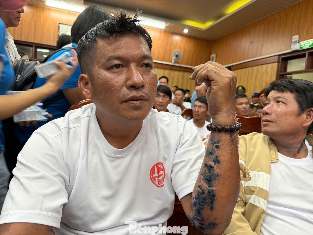 Thuyền trưởng Huỳnh Văn Trí trở về với những mảng da bong tróc sau nhiều ngày dầm mưa, phơi nắng giữa biển khơi. Ảnh Hoài Văn 4 ngày 3 đêm lênh đênh giữa biển: 32 ngư dân Đà Nẵng đã sống sót thế nào? - Ảnh 1.