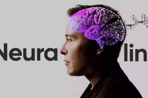 Neuralink cấy chip lên não người: Đột phá hay nói quá?