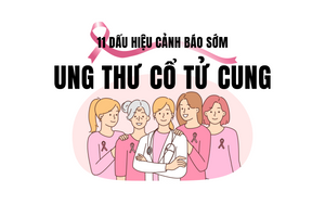 11 dấu hiệu đầu tiên trên cơ thể bạn cảnh báo về căn bệnh ung thư cổ tử cung