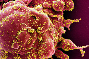 Láng giềng Việt Nam tạo đột phá chưa từng có: Dùng AI phát hiện 162.000 virus mới, chỉ mất 1 giây để xác định loài mới