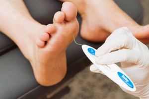 4 triệu chứng ở chân cảnh báo bệnh tiểu đường đã nghiêm trọng