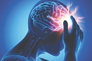 Việt Nam ghi nhận 200.000 ca đột quỵ mỗi năm: Bác sĩ Bệnh viện Trung ương Quân đội 108 chỉ ra thời gian 'vàng' để cứu sống người bệnh