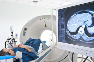 Theo quy định mới, bệnh nhân chụp PET/CT có được BHYT thanh toán không?