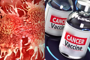 Việt Nam có thể sớm có vắc xin ung thư trên công nghệ mRNA hiện đại hàng đầu thế giới