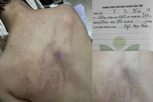 Tạm đình chỉ cô giáo mầm non đánh đập, kéo lê, ném bé gái 4 tuổi vào tường