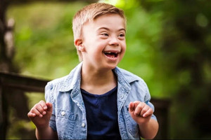 Nhật Bản tạo kỳ tích y học: Lần đầu tiên trong lịch sử loại bỏ thành công nhiễm sắc thể gây hội chứng Down