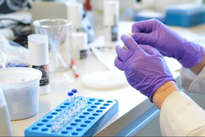 Vinapharm (DVN) hợp tác doanh nghiệp Nga, mở cơ hội chuyển giao công nghệ sản xuất thuốc