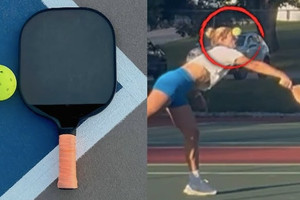 Nghiên cứu nói chơi pickleball có nguy cơ gây tổn thương nặng vùng mắt, thậm chí nguy cơ mù lòa