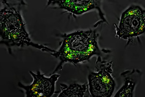 Phát hiện thuốc mới tiêu diệt tế bào ung thư mạnh gấp 20.000 lần, không gây tác dụng phụ