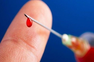 Virus ‘sát thủ’ lây nhanh gấp 100 lần HIV, Việt Nam thuộc nhóm có tỷ lệ nhiễm cao nhất khu vực