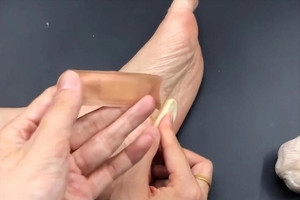 Người phụ nữ dán tỏi dưới lòng bàn chân mỗi khi đi ngủ, kết quả khám khiến bác sĩ ngã ngửa