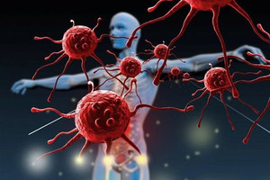 Việt Nam có hơn 180.000 ca ung thư mới mỗi năm, ung thư tuyến giáp chiếm tỷ lệ cao nhất