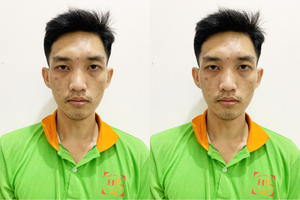 Nguyễn Quốc Thịnh, 30 tuổi bị truy nã vì trộm 17kg khô mực ra đầu thú