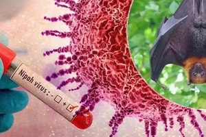 5 lý do khiến WHO xếp Nipah vào nhóm mầm bệnh nguy hiểm nhất thế giới