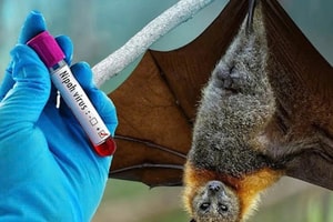 Bác sĩ cảnh báo 5 vật dụng không thể thiếu trong nhà để phòng virus Nipah