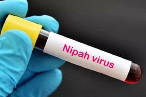 Chính thức: Bộ Y tế ban hành phác đồ điều trị virus Nipah