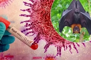 Bộ Y tế công bố phác đồ chẩn đoán và điều trị virus Nipah