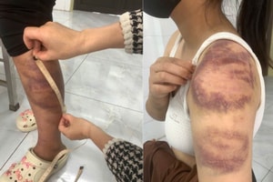 Tạm giữ hình sự Phan Văn Minh 32 tuổi bạo hành vợ bầu và con gái 13 tuổi