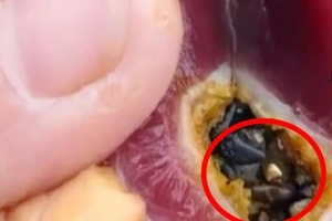 Người đàn ông phát hiện gần 3 chỉ vàng, trị giá gần 50 triệu bên trong dạ dày vịt